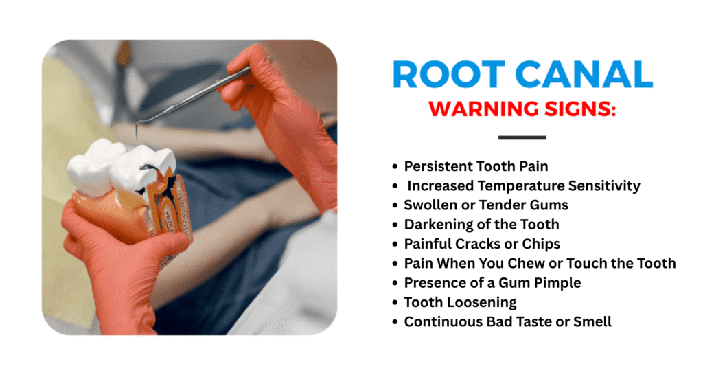 Root canal warning signs 
