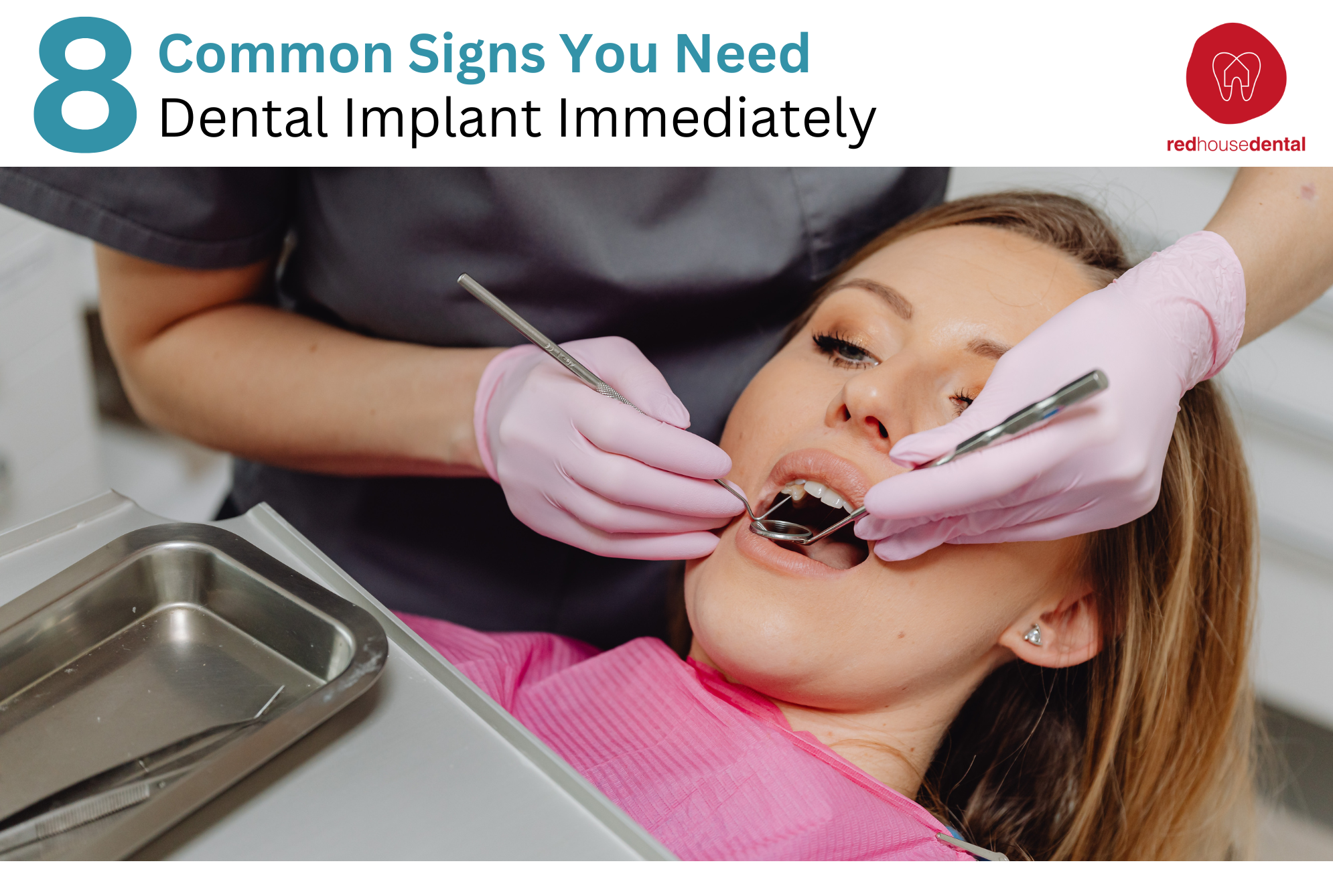 8 Common Signs You Need A Dental Implant Immediately