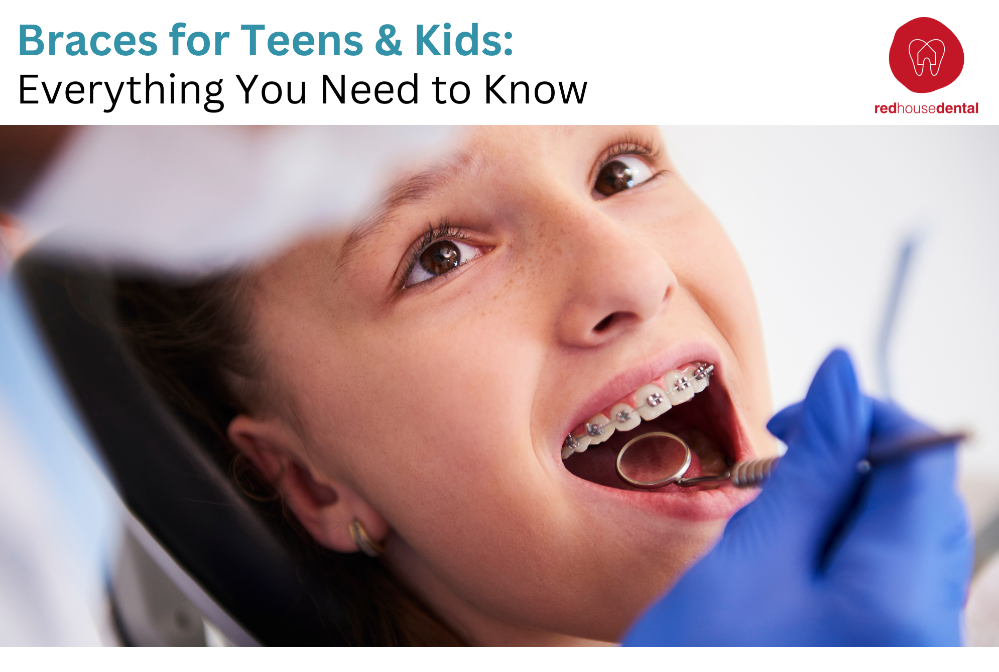 Braces for Teens & Kids
