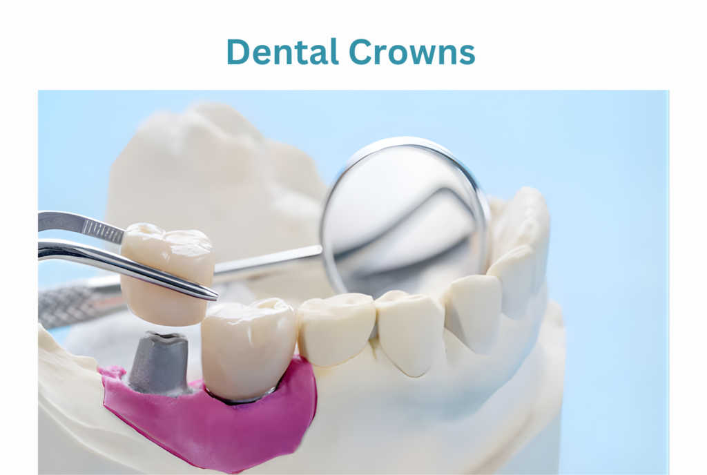types of dental crowns and cost