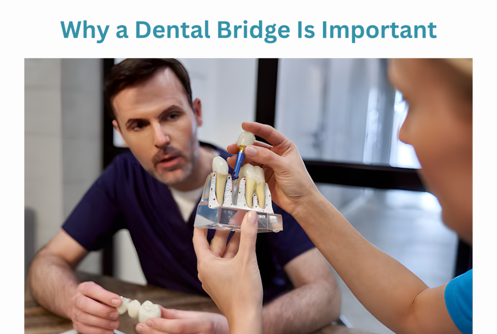 Dental Bridge