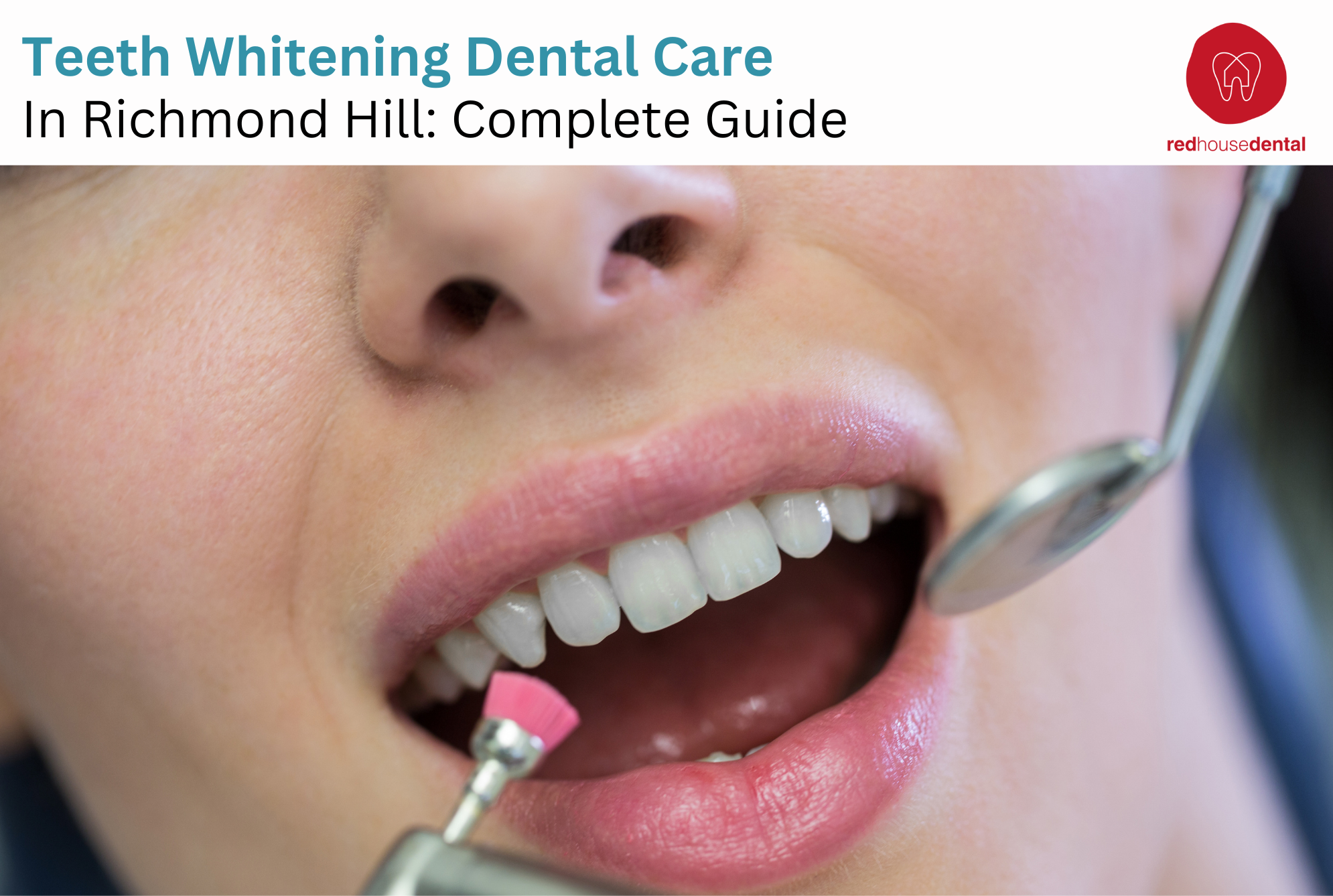 teeth whitening dental care