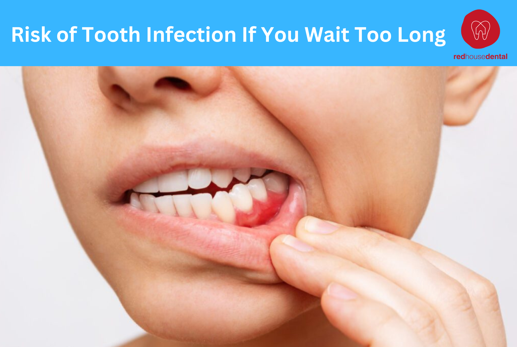 Signs of Tooth Infection You Should Never Ignore
