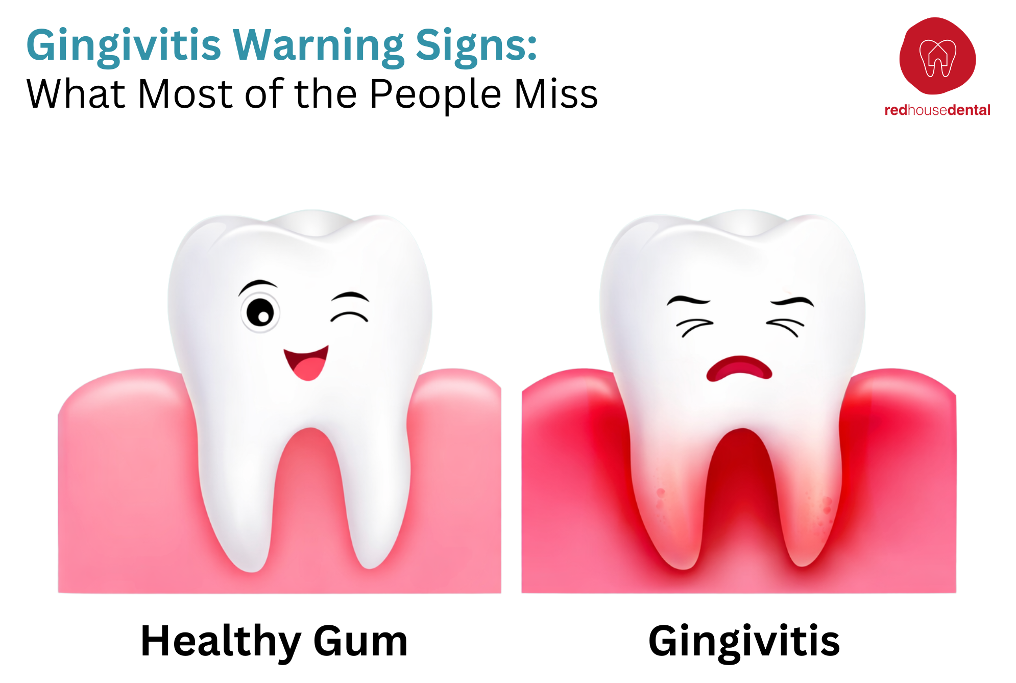 gingivitis