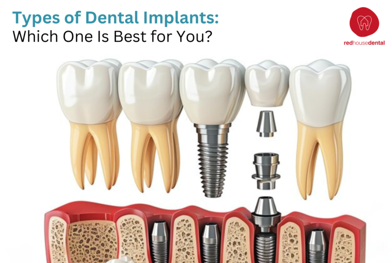 types of dental implants