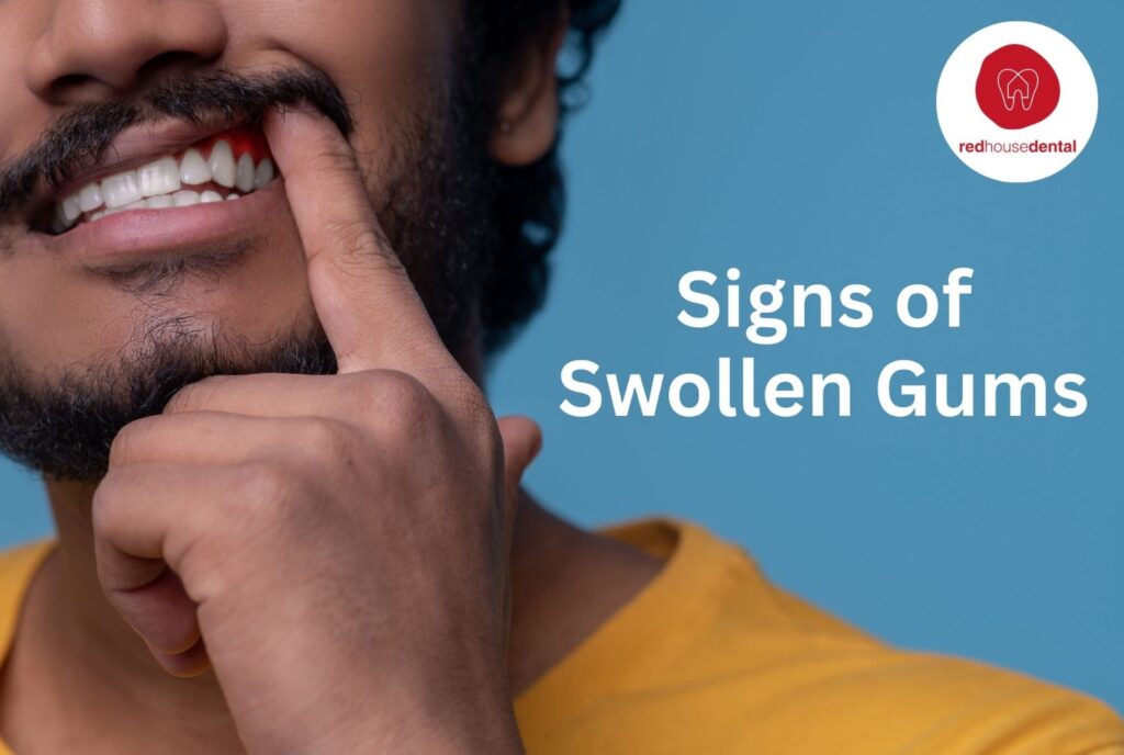 swollen gums