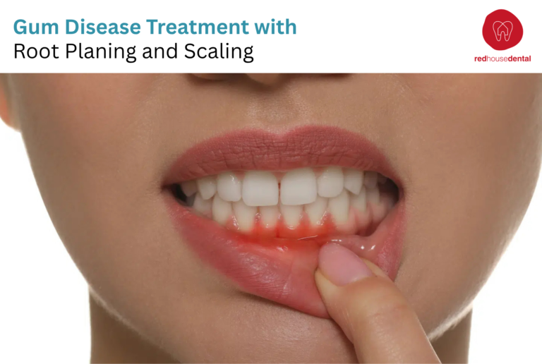 Gum Disease Treatment with Root Planning and Scaling