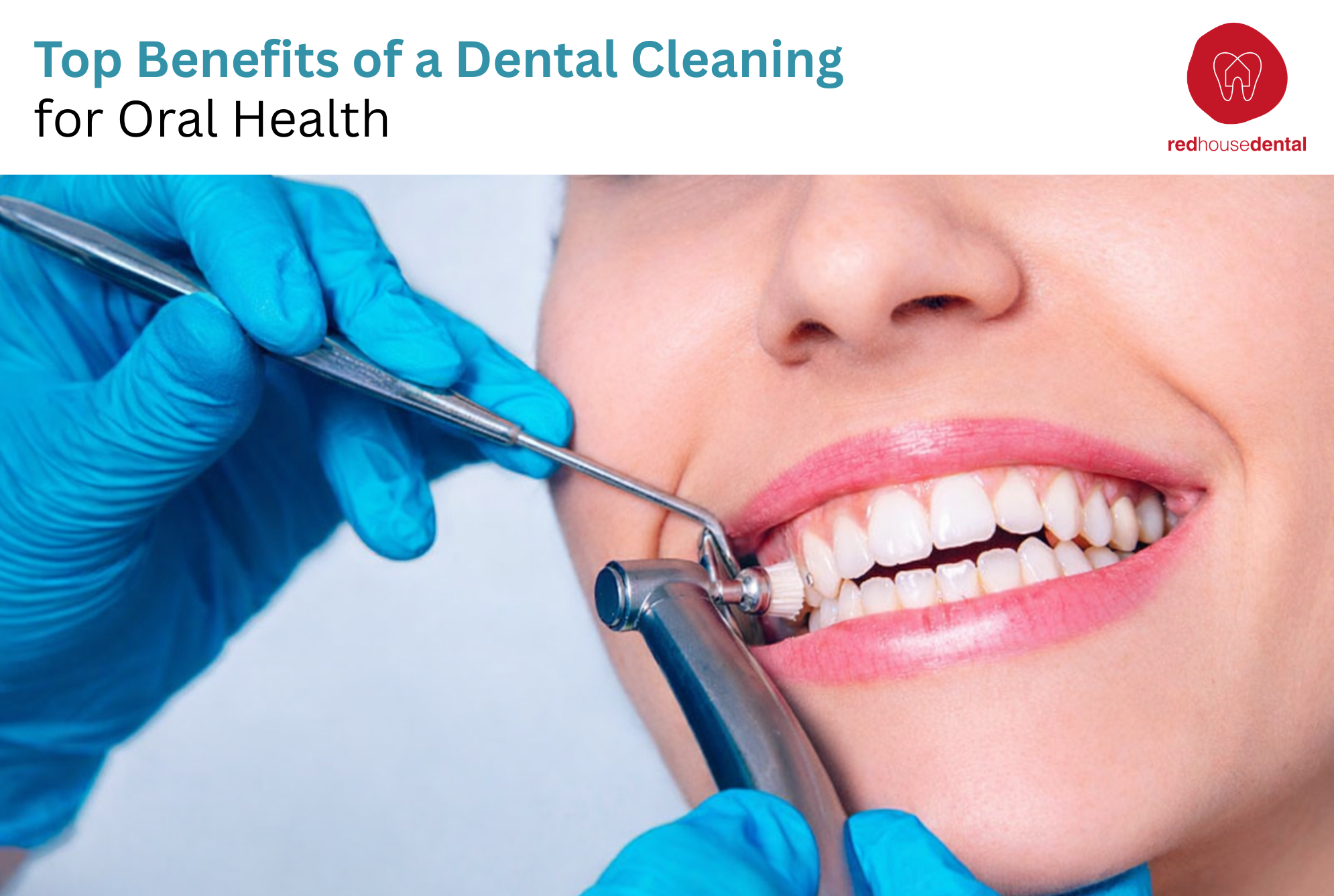 dental cleaning