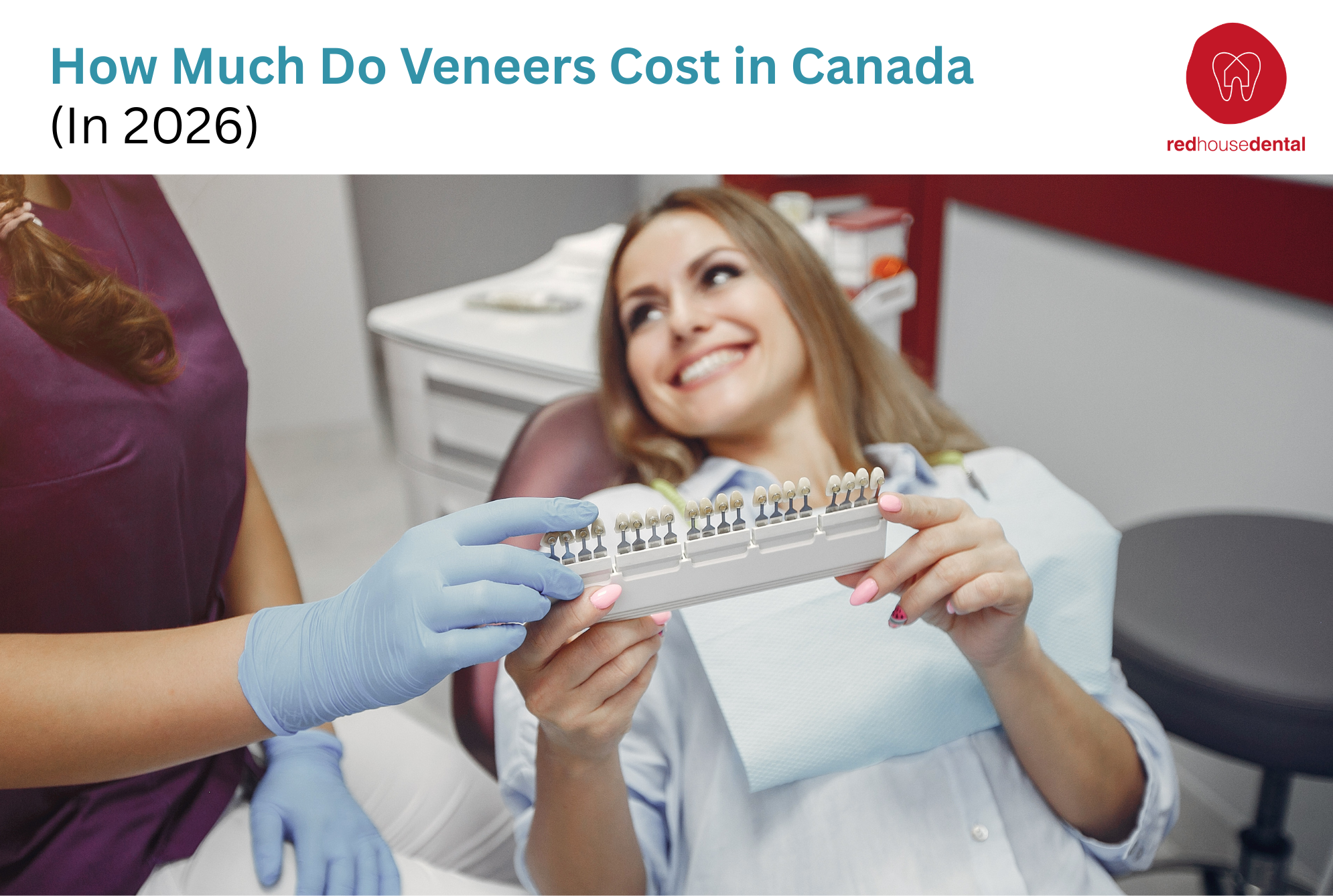 How Much do Veneers Cost in Canada (In 2026)