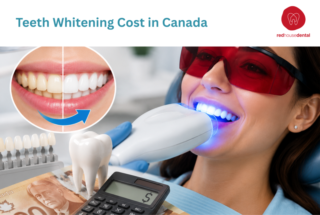 teeth whitening