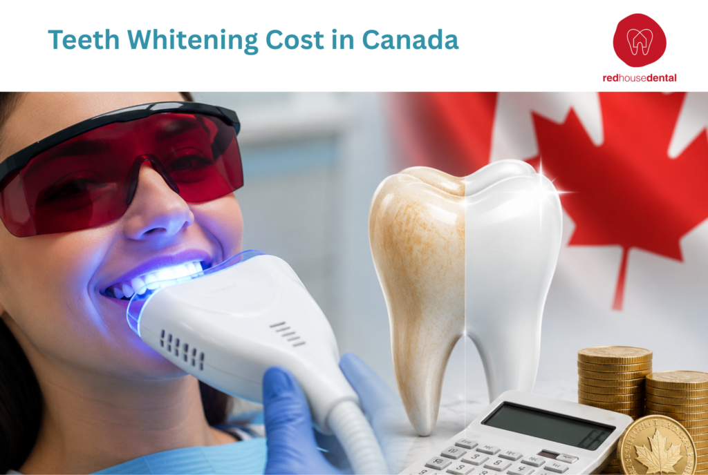 teeth whitening