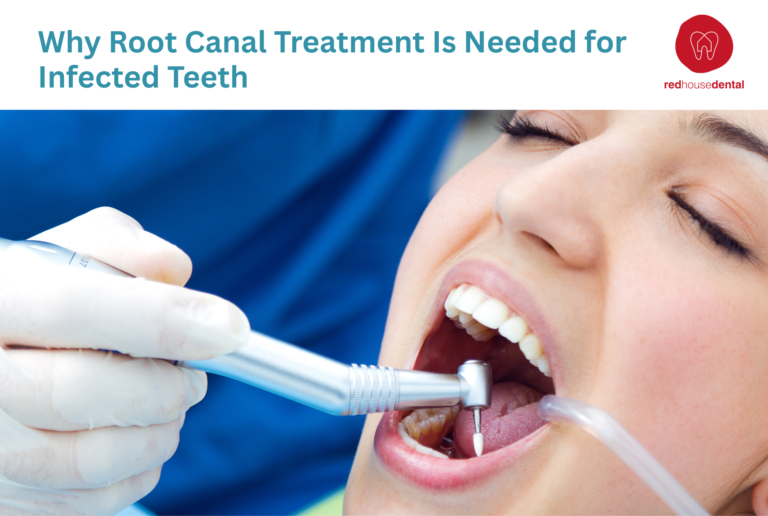 root canal treatment
