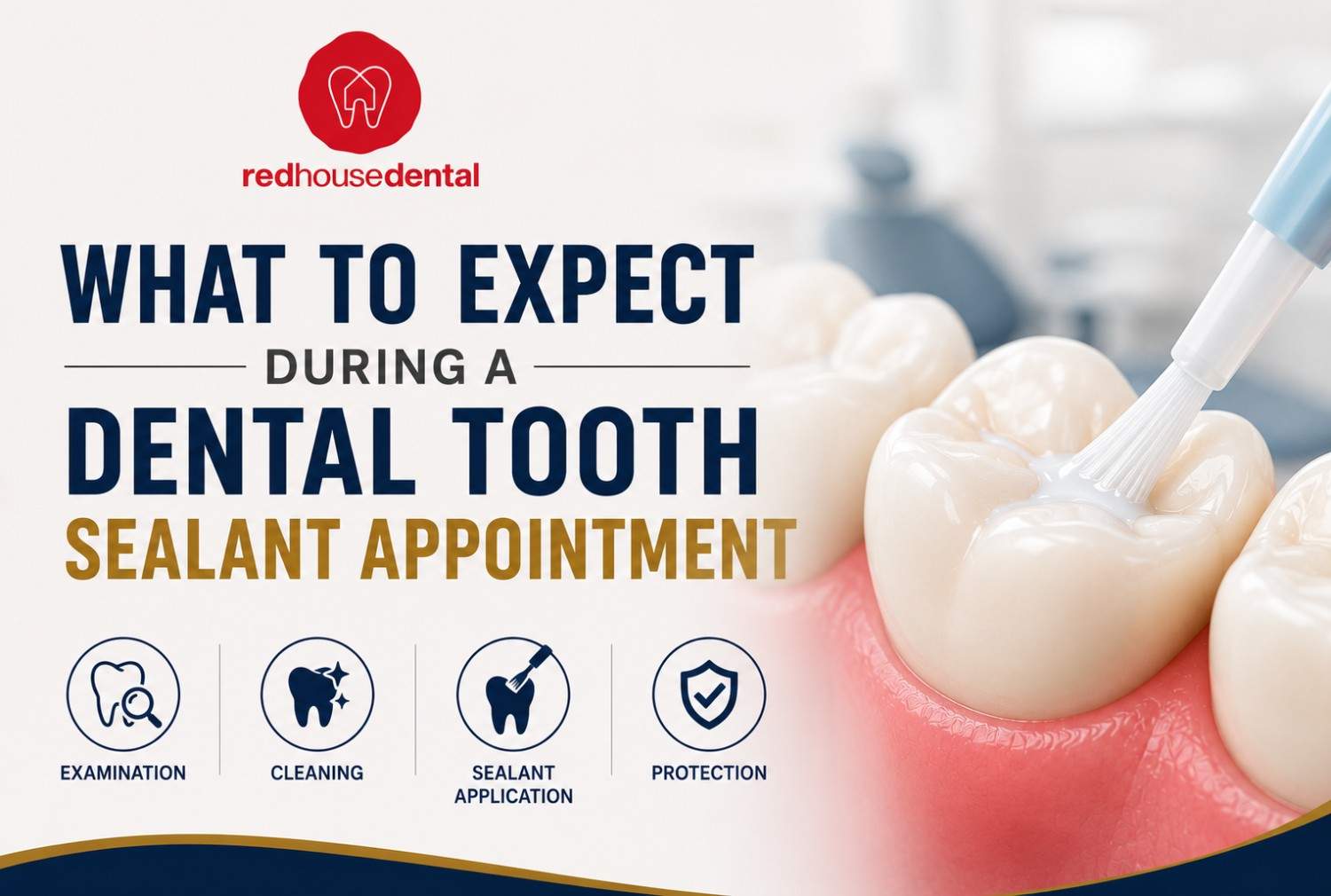 Tooth Sealant