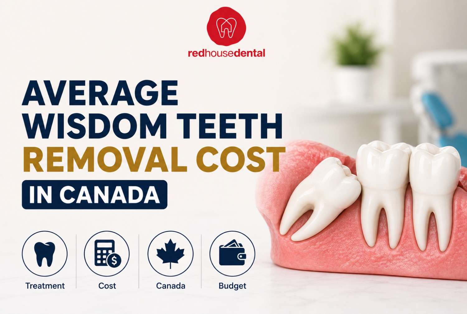 Wisdom Teeth Removal