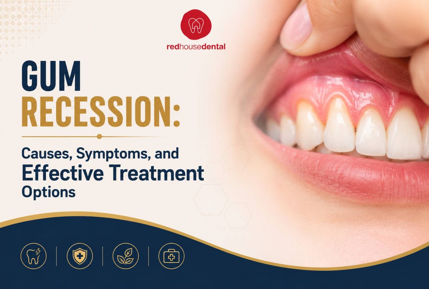 Gum Recession