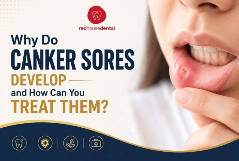 canker sore